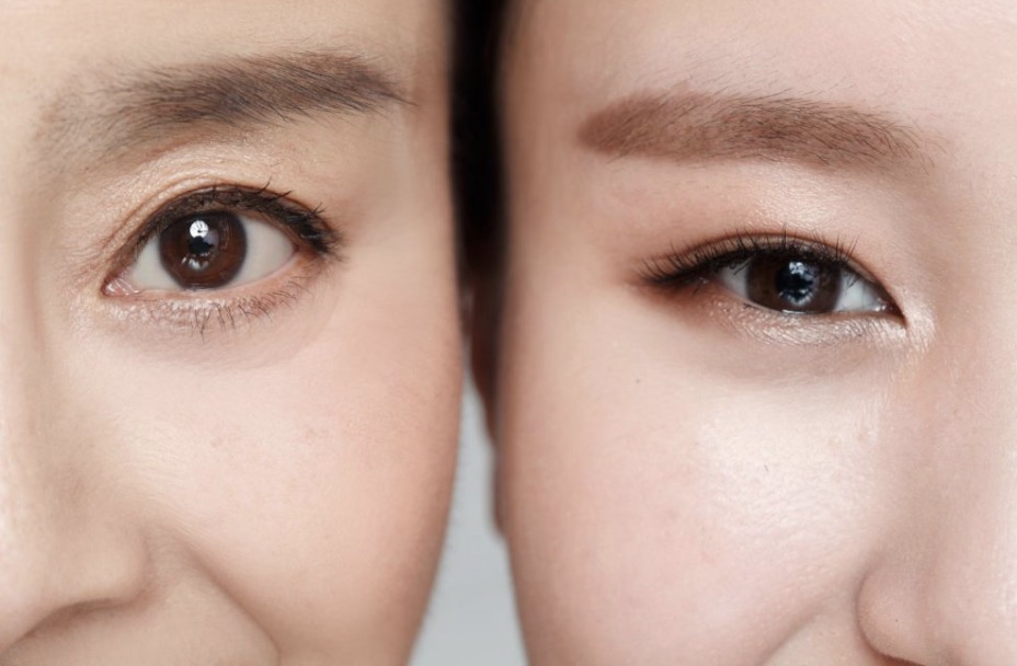 Chi ph&iacute; mở rộng g&oacute;c mắt mới nhất